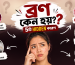 ব্রণ কেন হয় ৫টি Hidden কারণ যা আপনি জানতেন না Glovelix - skin care